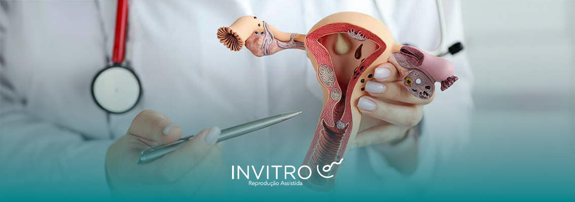 tratamentos para engravidar para quem tem SOP